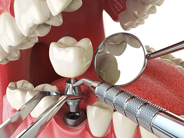 Best Broken Tooth Emergency  in Montrose Ghent, OH