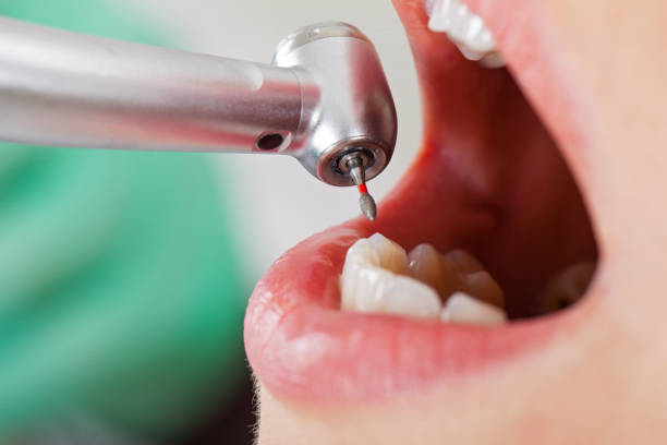 Best Emergency Dentist for Kids  in Montrose Ghent, OH
